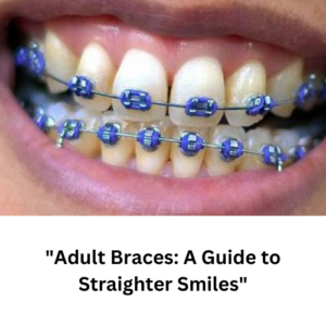 "Adult Braces: A Guide to Straighter Smiles"
